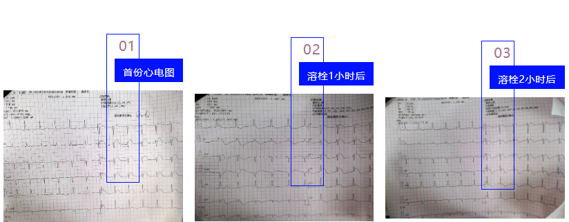 微信截图_20220928082509.png